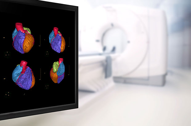 Cardiac Computed Tomography (CT) at The Cardiac Centre NSW