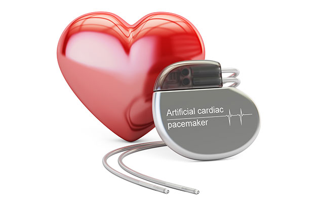 Electronic Device Implantation (loop recorder, pacemaker, defibrillator) at The Cardiac Centre NSW