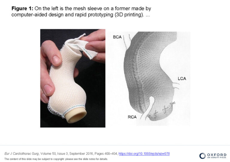 The PEARS procedure The Cardiac Centre